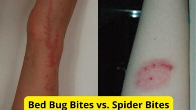Bed Spider Bites