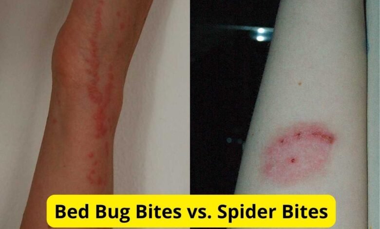 Bed Spider Bites